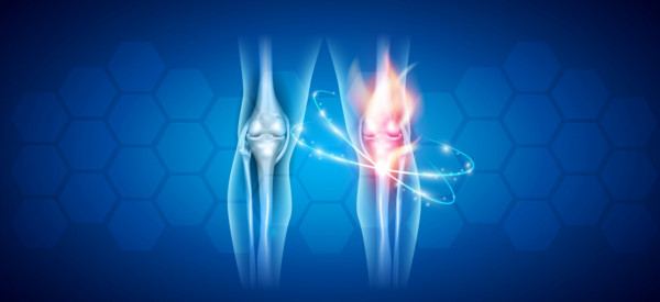 Osteoartritis kolena - prevencija i lečenje