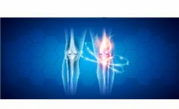 Osteoartrisis kolena i tretman bola - primena kristalnog glukozamin sulfata